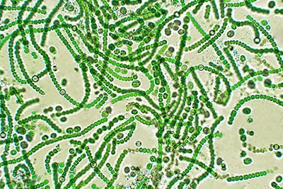 microscopic view of a harmful algal bloom